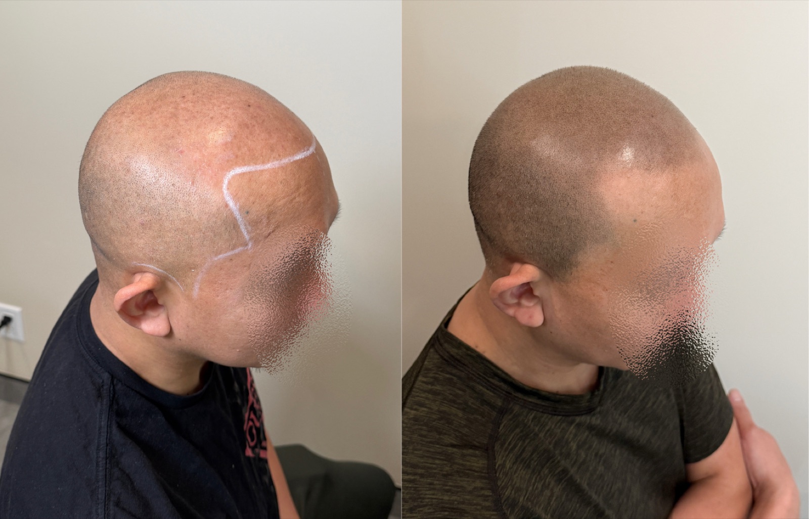 Shaved look SMP portfolio 10